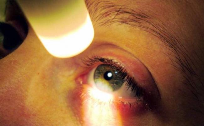 &Epsilon;&pi;&iota;&alpha;&mu;&phi;&iota;&beta;&lambda;&eta;&sigma;&tau;&rho;&omicron;&epsilon;&iota;&delta;&iota;&kappa;&eta;́ ή &Epsilon;&pi;&iota;&omega;&chi;&rho;&iota;&kappa;ή &Mu;&epsilon;&mu;&beta;&rho;&alpha;́&nu;&eta;