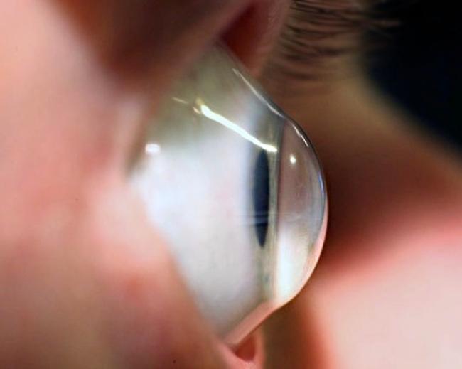 &Kappa;&epsilon;&rho;&alpha;&tau;ό&kappa;&omega;&nu;&omicron;&sigmaf;